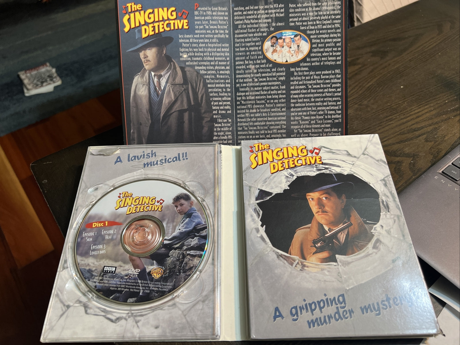 The Singing Detective Complete Series BBC DVD 2003 3-Disc Set Good condition